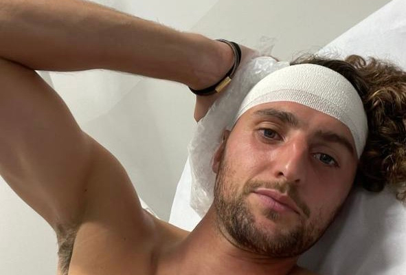 Rabiot needed six stitches after clash with Juventus teammate Bremer